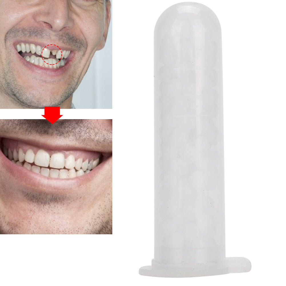 Temporary Tooth Repair Beads Missing Broken Teeth
