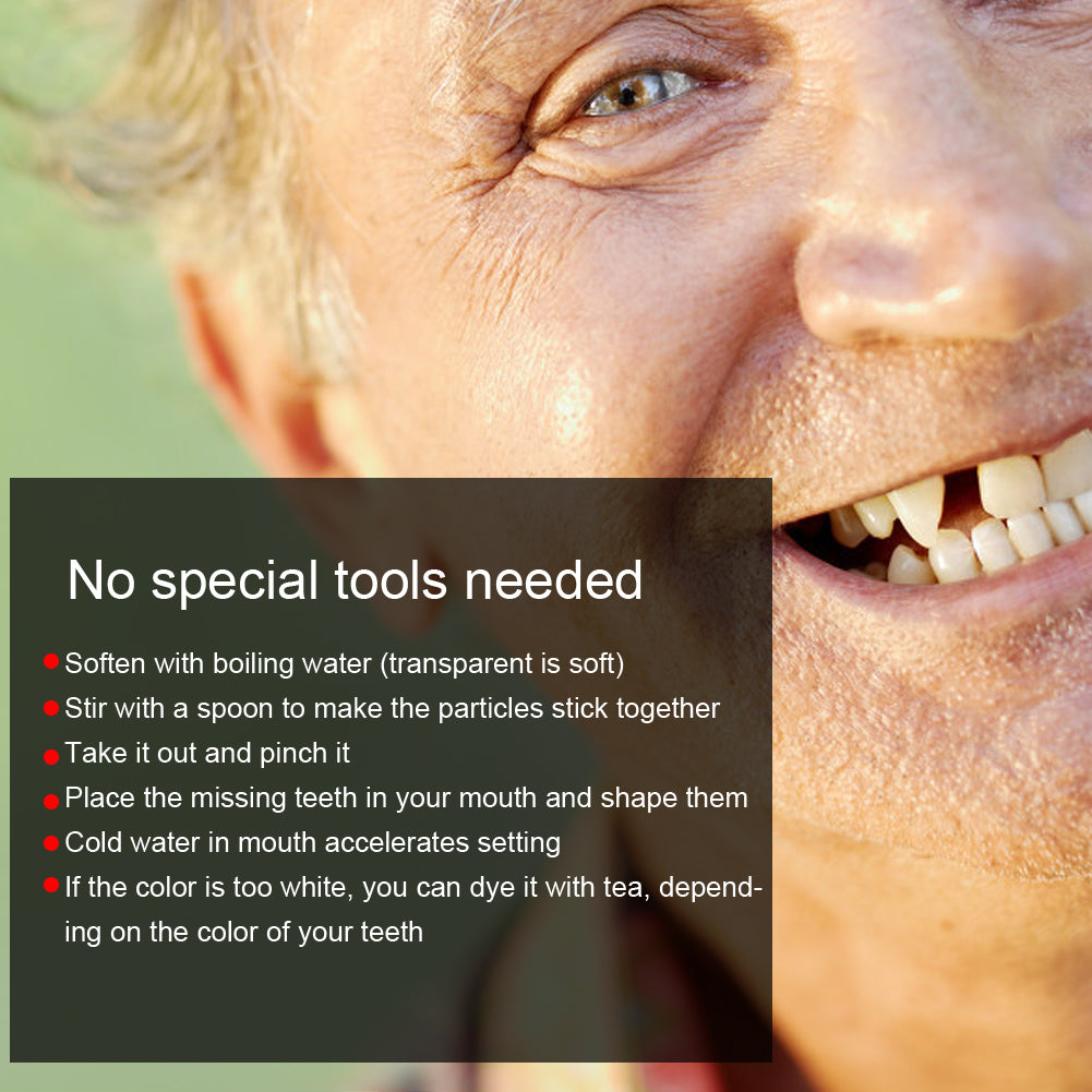 Temporary Tooth Repair Beads Missing Broken Teeth